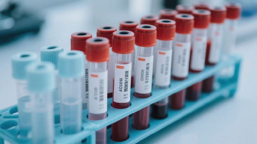 亲子鉴定技术原理及孕期鉴定全科普